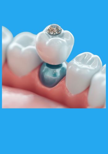 Restorative Dentistry